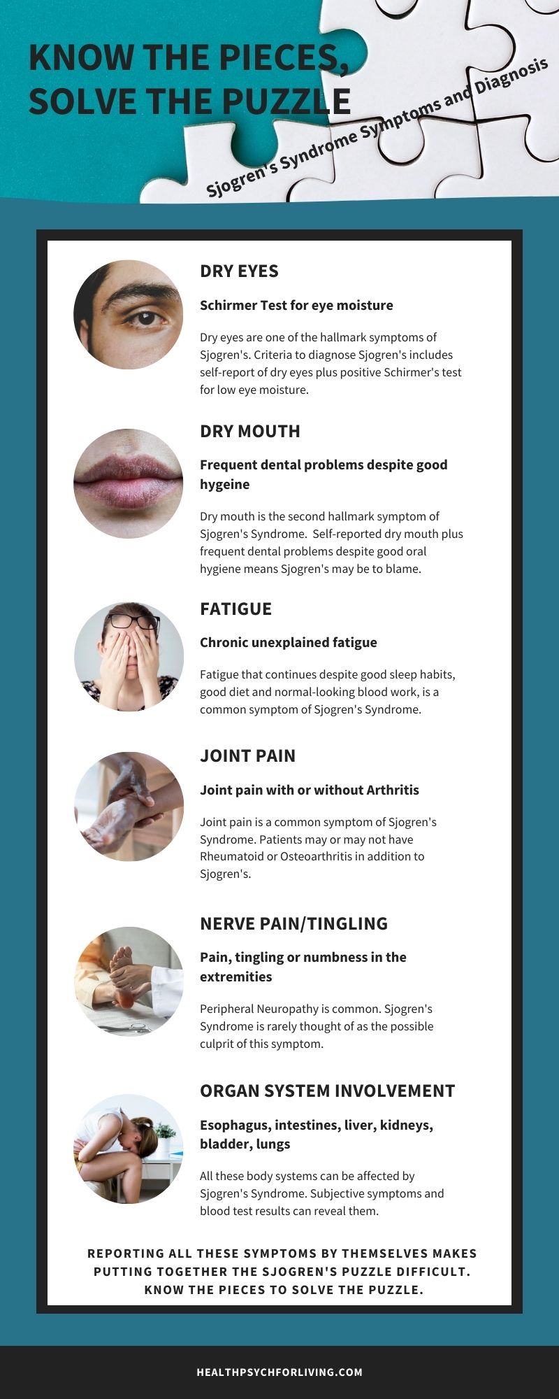 Sjogren's syndrome symptoms and diagnosis infographic